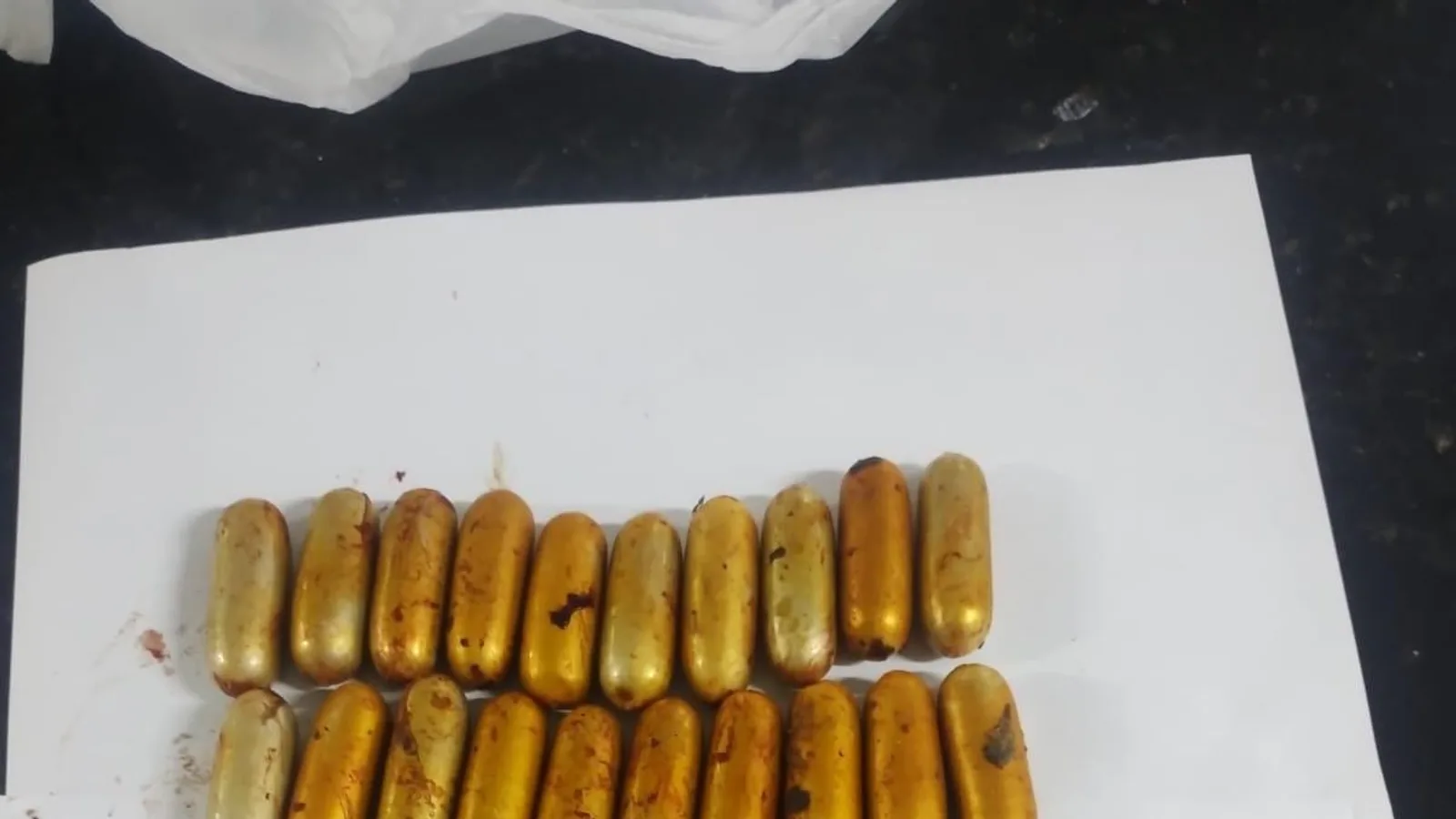 PCRN prende homem por tráfico de drogas após cirurgia para retirada de 38 cápsulas de cocaína do organismo