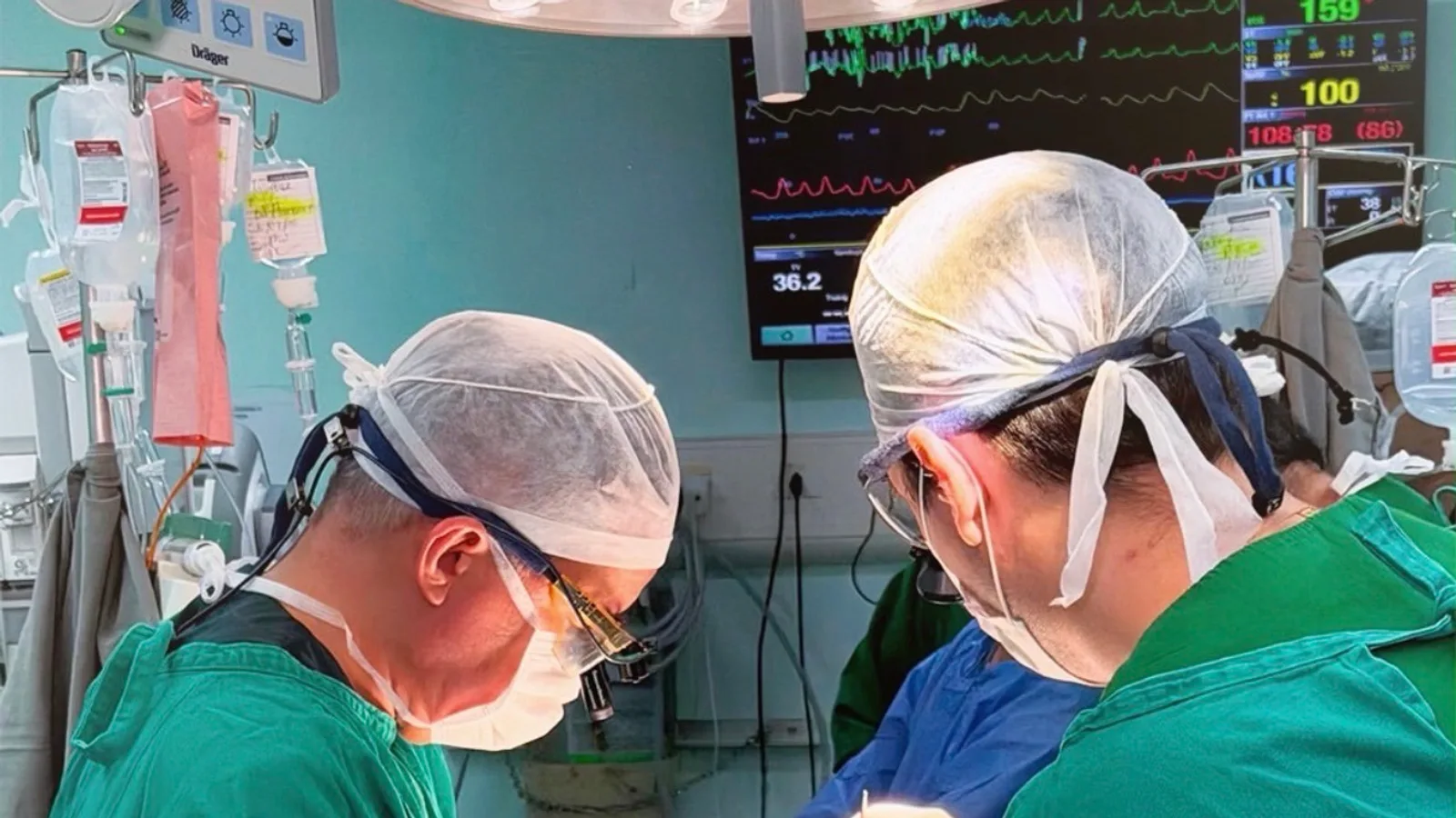 Médicos do Hospital Rio Grande concluem com sucesso transplante de coração em homem de 67 anos em Natal