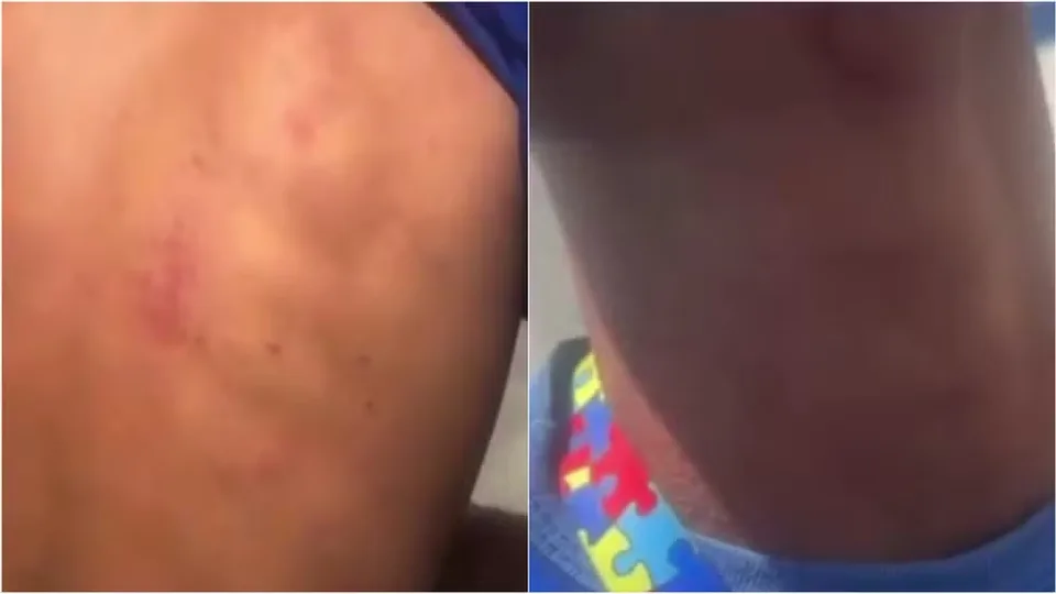 PM afasta policiais após abordagem a jovem autista no interior do RN